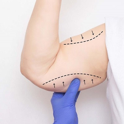 شد الذراعين في مسقط