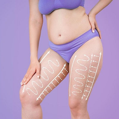 Thigh Lift in Muscat