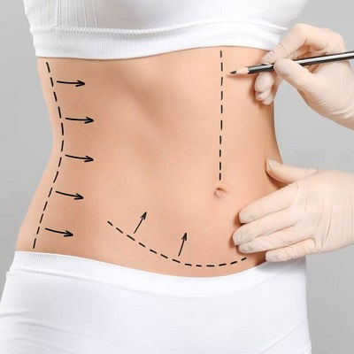 Waist Sculpting Muscat