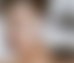ما هي حقن الفيلر الجلدي وكيف تعمل؟