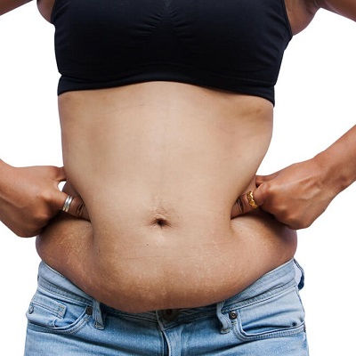 Best Post Weight Loss Muscat