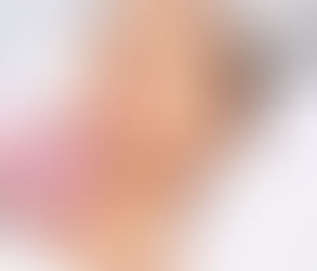 Do Lip Fillers Make You Look Fake?