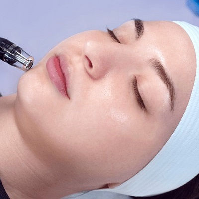 Best Microdermabrasion Muscat