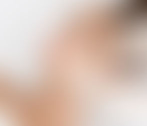 كيف تساعد حقن البوتوكس في تقليل الخطوط الدقيقة والتجاعيد