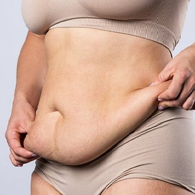 Post Weight Loss Oman