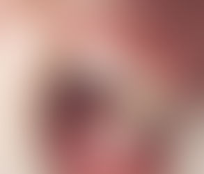 The Impact of Composite Fillings on Your Dental Health in Dubai