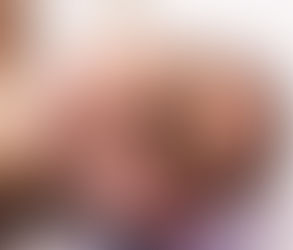 Is OxyGeneo Facial Right for Your Skin Type?