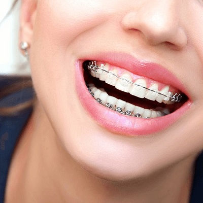 Orthodontists Dubai
