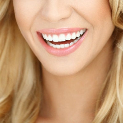 Hollywood Smile in Dubai