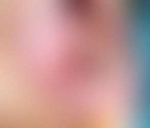 Teeth Cleaning for Athletes: Tips for Maintaining Oral Health in Dubai