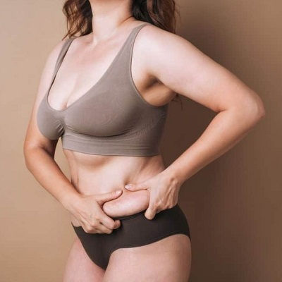 Post Weight Loss Clinic in Oman
