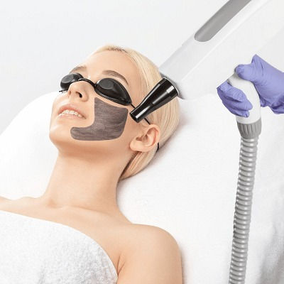 Best Laser Carbon Peel Oman