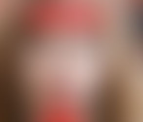 Dental Headgear and Confidence: Supporting Your Teen