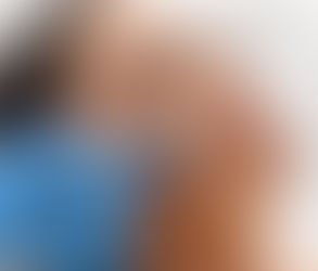 كيف يمكن جراحة التجميلية أن تحسن صورة الجسم