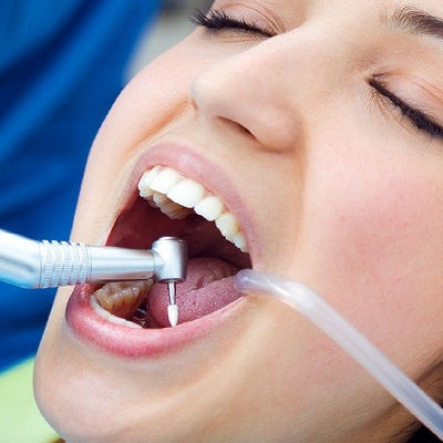 Root Canal Treatment Dubai
