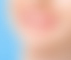 Can Dental Veneers Fix Gaps Between Teeth?