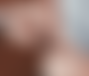 حقن أوزمبيك والصحة النفسية: هل ثمة علاقة؟