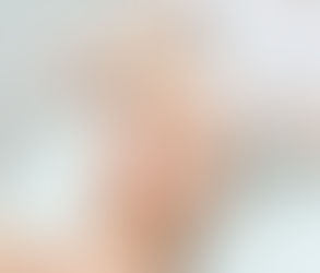 تقشير حمض ثلاثي كلورو أسيتيك : كيفية الحصول على بشرة ناعمة ومشرقة