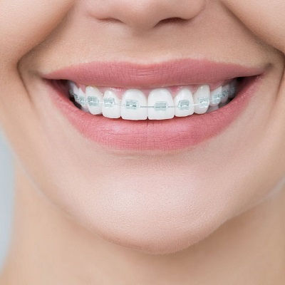 Orthodontists in Dubai
