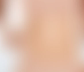 تأثير تقلبات الوزن على نتائج عملية شد البطن