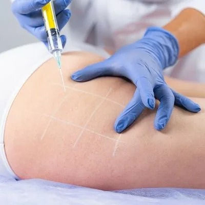 Fat Melting Injections Muscat