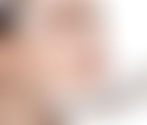 How Profhilo Enhances Skin Elasticity: Insights from Muscat Experts