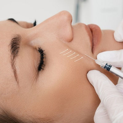 Best Profhilo Clinic Muscat