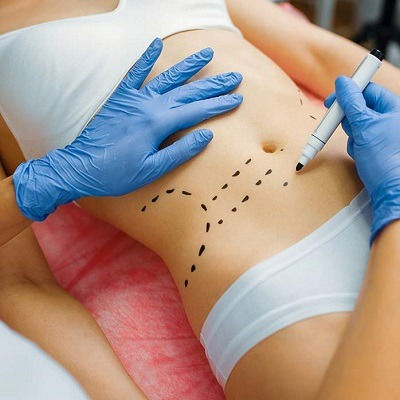 Best Fat Melting Injections in Oman