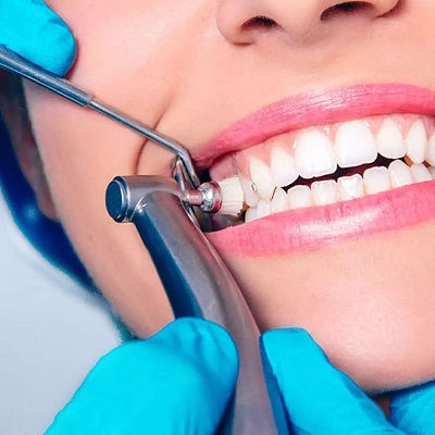 Teeth Cleaning in Dubai