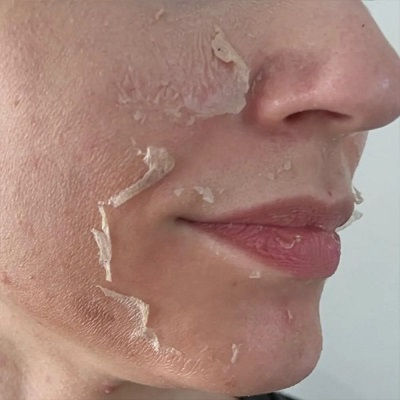 TCA Peel in Oman