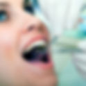 Why Early Treatment Matters: Dental Fillings in Dubai