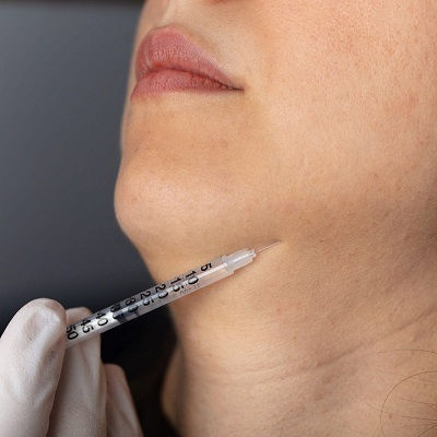 Best Jawline Fillers Injections Muscat
