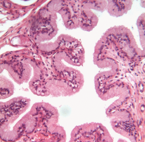 Transitional_epithelium_animated.gif