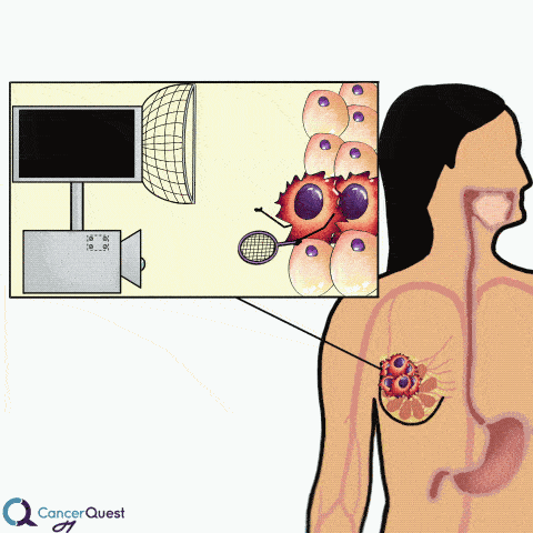 Ultrasound_Sq.gif