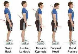 Breaking Bad Habits: Principles of Posture