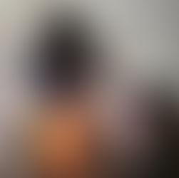 Avanço na Saúde: Tratamento da retinopatia diabética passa a ser realizado no Amapá com tecnologia a laser