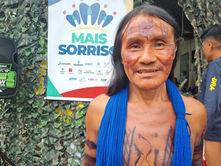 Indígena que passou 10 anos sem mastigar carne ganhou prótese do “Doutores da Amazônia"