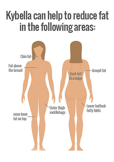 Kybella for double chin, bra fat, knee fat and bananroll