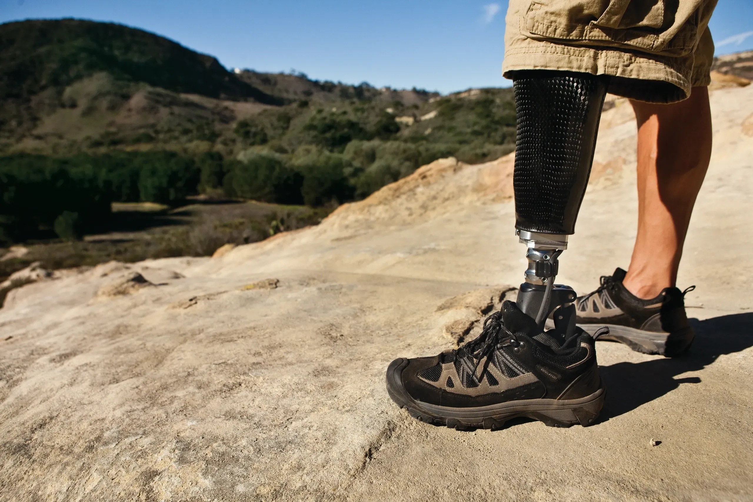 prosthetic leg