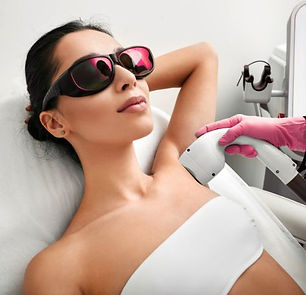 A woman having underam laser hair removal at Define by Marie Dolan Warwickshire.