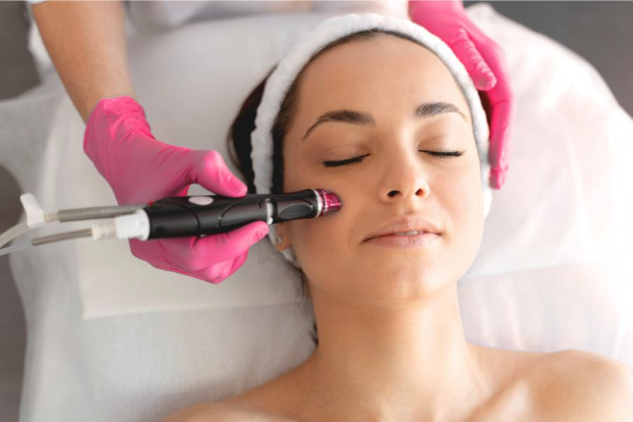what is microdermabrasion facial. Treatment available at define aesthetics clinic in alcester.