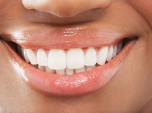 A darker skined woman smiling at the camera having a Sculptra Treatment