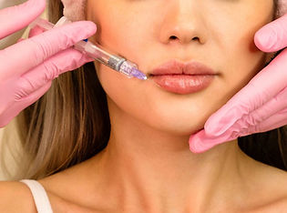 Dermal Filler