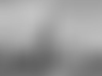 Seeing through my eyes: Simulating Keratoconus vision using OpenCV