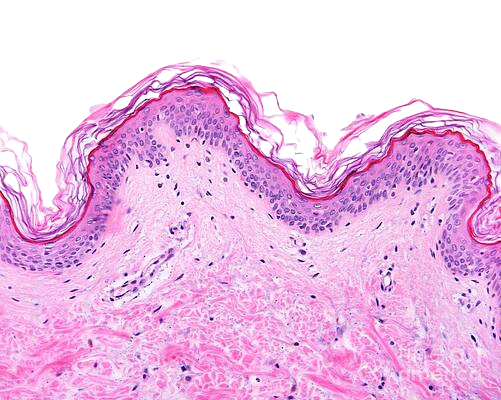 2-skin-jose-calvoscience-photo-library_edited.png