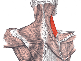 Why Muscle Knots Aren't Your Biggest Problem