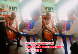 รย กระดูกทับเส้น เบาหวาน12ปี