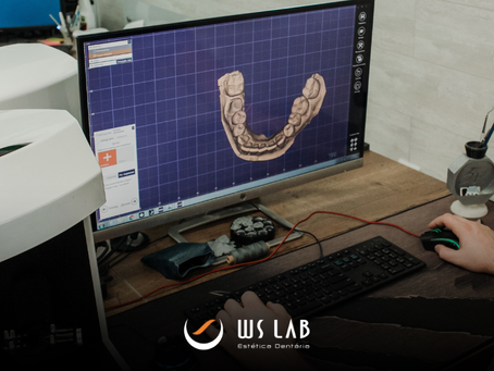 Fluxo digital na odontologia: como otimizar a comunicação entre clínica e laboratório
