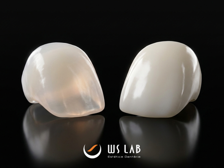 Dissilicato de Lítio ou Zircônia: Qual Material Oferece Mais Resistência e Qual é a Melhor Indicação?