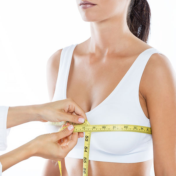 MAMOPLASTIA REDUTORA